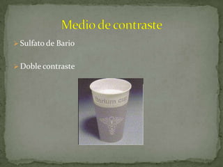  Sulfato de Bario


 Doble contraste
 