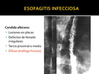 Esofagograma | PPT