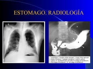 ESTOMAGO. RADIOLOGÍA
 