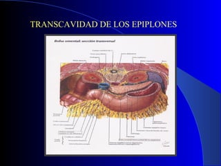 TRANSCAVIDAD DE LOS EPIPLONES
 