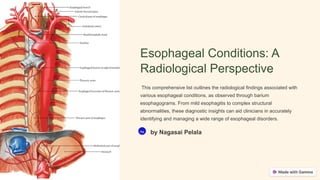 Esophageal Conditions: A
Radiological Perspective
This comprehensive list outlines the radiological findings associated with
various esophageal conditions, as observed through barium
esophagograms. From mild esophagitis to complex structural
abnormalities, these diagnostic insights can aid clinicians in accurately
identifying and managing a wide range of esophageal disorders.
Na by Nagasai Pelala
 