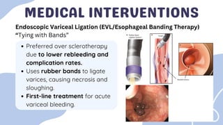 Esophageal-Varices-20250317_123341_0000.pdf