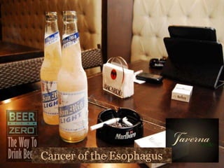 Cancer of the Esophagus
 