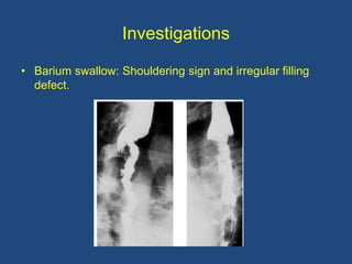 Investigations
• Barium swallow: Shouldering sign and irregular filling
defect.
 