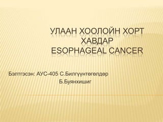 УЛААН ХООЛОЙН ХОРТ
ХАВДАР
ESOPHAGEAL CANCER
Бэлтгэсэн: АУС-405 С.Билгүүнтөгөлдөр
Б.Буянхишиг
 