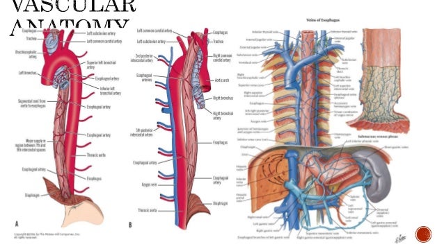 Esophageal cancer