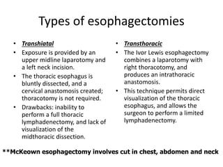 Esophageal cancer | PPTX