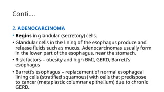 adult health nursing esophageal cancer.pptx