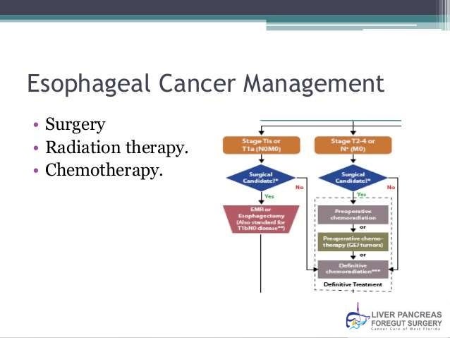 Esophageal cancer Treatment Florida