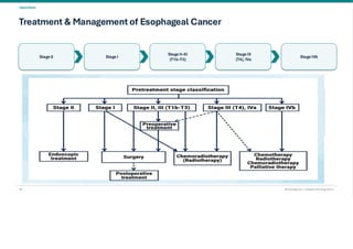 Esophageal Cancer & it's Management. pdf