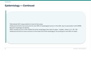Esophageal Cancer & it's Management. pdf