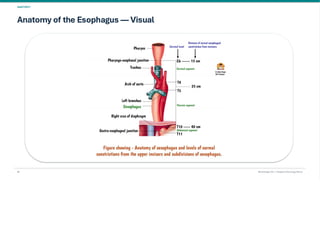 Esophageal Cancer & it's Management. pdf