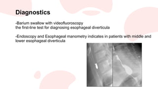 Esophageal diseases .pdf by university of kufa college of medicine | PDF