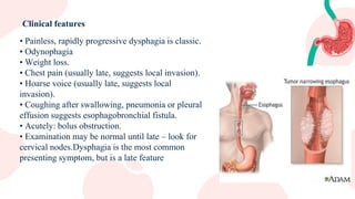 Esophageal diseases .pdf by university of kufa college of medicine | PDF