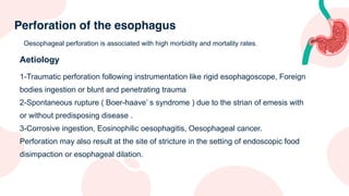Esophageal diseases .pdf by university of kufa college of medicine | PDF
