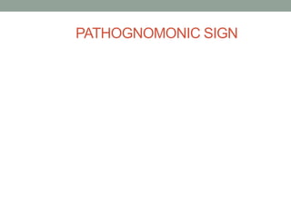 PATHOGNOMONIC SIGN
 