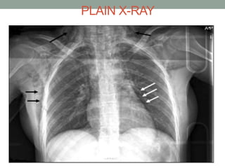 PLAIN X-RAY
 