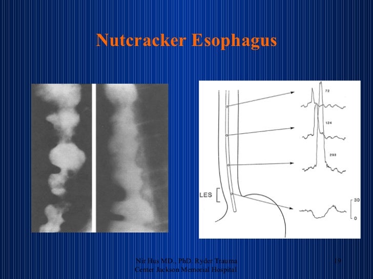 Esophagus review 1 Nir Hus MD., PhD.
