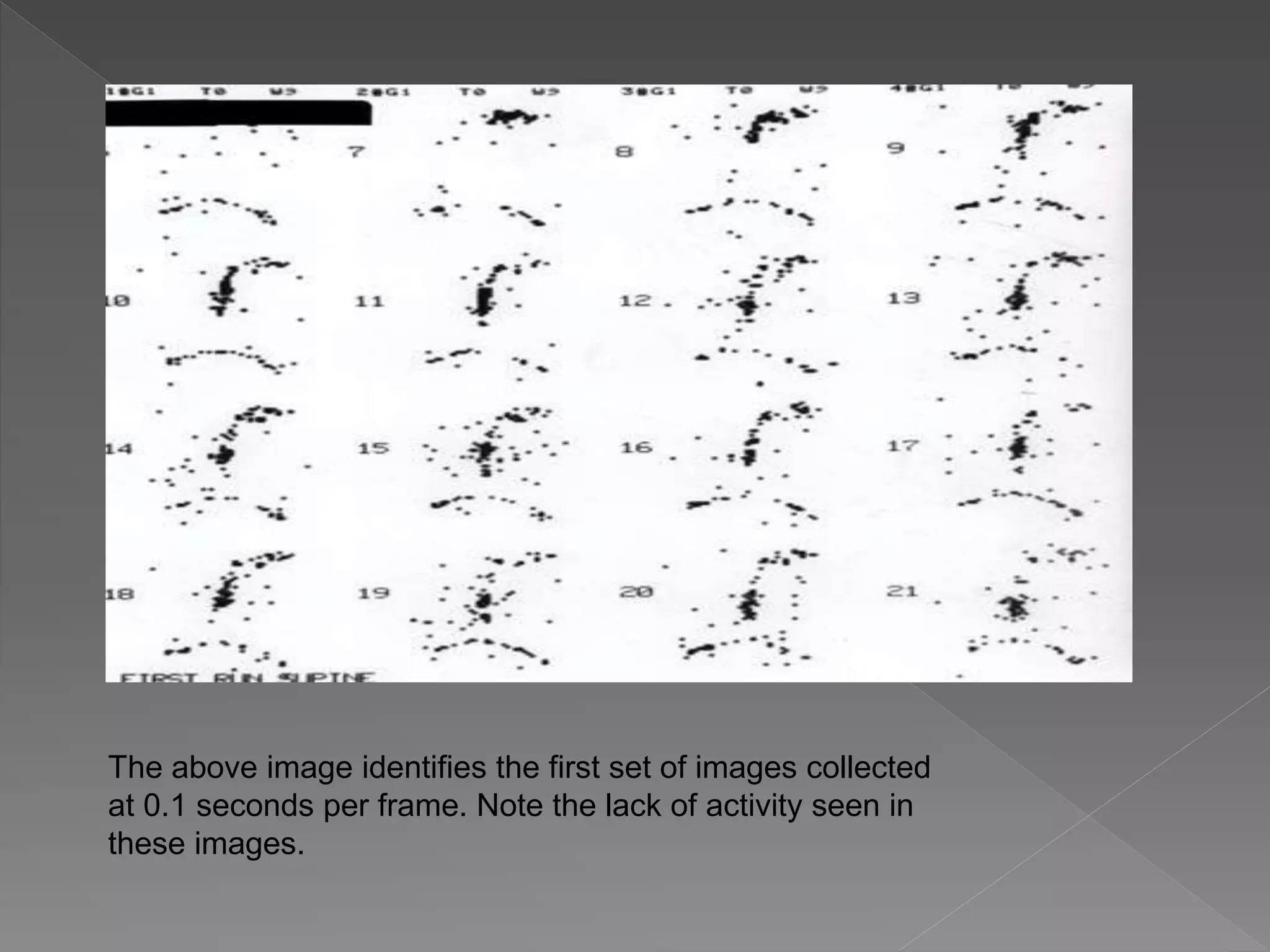 Esophageal transit imaging | PPTX