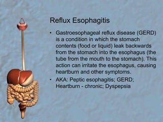 Reflux EsophagitisGastroesophageal reflux disease (GERD) is a condition in which the stomach contents (food or liquid) leak backwards from the stomach into the esophagus (the tube from the mouth to the stomach). This action can irritate the esophagus, causing heartburn and other symptoms.AKA: Peptic esophagitis; GERD; Heartburn - chronic; Dyspepsia 