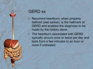 GERD sxRecurrent heartburn, when properly defined (see earlier), is the hallmark of GERD and enables the diagnosis to be made by the history alone.The heartburn associated with GERD typically occurs once or twice per day and lasts from a few minutes to an hour or more if untreated.