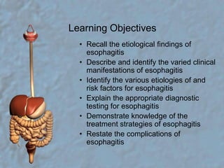 Learning ObjectivesRecall the etiological findings of esophagitisDescribe and identify the varied clinical manifestations of esophagitisIdentify the various etiologies of and risk factors for esophagitisExplain the appropriate diagnostic testing for esophagitisDemonstrate knowledge of the treatment strategies of esophagitisRestate the complications of esophagitis                                                                    