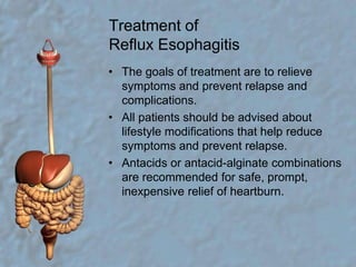 Treatment of Reflux EsophagitisThe goals of treatment are to relieve symptoms and prevent relapse and complications.All patients should be advised about lifestyle modifications that help reduce symptoms and prevent relapse.Antacids or antacid-alginate combinations are recommended for safe, prompt, inexpensive relief of heartburn.
