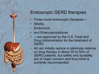 Endoscopic GERD therapiesThree novel endoscopic therapies—Stretta,EndoCinch,and Enteryxprocedures—are approved by the U.S. Food and Drug Administration for the treatment of GERD.All can initially reduce or eliminate reliance on drug therapy in about 30 to 50% of GERD patients, but safety and durability are of major concern and thus none is currently recommended. 