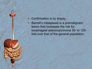Confirmation is by biopsy.Barrett's metaplasia is a premalignant lesion that increases the risk for esophageal adenocarcinoma 30- to 125-fold over that of the general population.