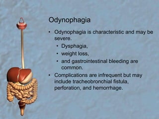 OdynophagiaOdynophagia is characteristic and may be severe.Dysphagia,weight loss,and gastrointestinal bleeding are common.Complications are infrequent but may include tracheobronchial fistula, perforation, and hemorrhage.  