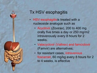 Tx HSV esophagitisHSV esophagitisis treated with a nucleoside analogue such asAcyclovir (Zovirax), 200 to 400 mg orally five times a day or 250 mg/m2 intravenously every 8 hours for 2 weeks.Valacyclovir (Valtrex) and famciclovir (Famvir) are alternatives;for resistant cases, intravenous foscarnet, 60 mg/kg every 8 hours for 2 to 4 weeks, is effective
