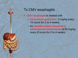 Tx CMV esophagitisCMV esophagitisis treated withintravenous ganciclovir, 5 mg/kg every 12 hours for 2 to 4 weeks;for resistant cases, foscarnet is administered intravenously at 60 mg/kg every 8 hours for 2 to 4 weeks.