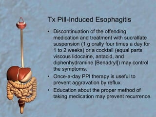 Tx Pill-Induced EsophagitisDiscontinuation of the offending medication and treatment with sucralfate suspension (1 g orally four times a day for 1 to 2 weeks) or a cocktail (equal parts viscous lidocaine, antacid, and diphenhydramine [Benadryl]) may control the symptoms.Once-a-day PPI therapy is useful to prevent aggravation by reflux.Education about the proper method of taking medication may prevent recurrence.