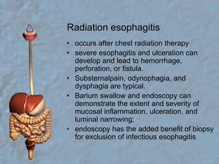 Radiation esophagitisoccurs after chest radiation therapysevere esophagitis and ulceration can develop and lead to hemorrhage, perforation, or fistula. Substernalpain, odynophagia, and dysphagia are typical.Barium swallow and endoscopy can demonstrate the extent and severity of mucosal inflammation, ulceration, and luminal narrowing;endoscopy has the added benefit of biopsy for exclusion of infectious esophagitis