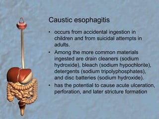 Caustic esophagitisoccurs from accidental ingestion in children and from suicidal attempts in adults.Among the more common materials ingested are drain cleaners (sodium hydroxide), bleach (sodium hypochlorite), detergents (sodium tripolyphosphates), and disc batteries (sodium hydroxide).has the potential to cause acute ulceration, perforation, and later stricture formation