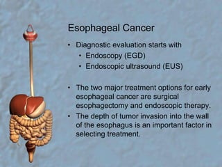 Esophageal CancerDiagnostic evaluation starts with Endoscopy (EGD)Endoscopic ultrasound (EUS)The two major treatment options for early esophageal cancer are surgical esophagectomy and endoscopic therapy. The depth of tumor invasion into the wall of the esophagus is an important factor in selecting treatment.