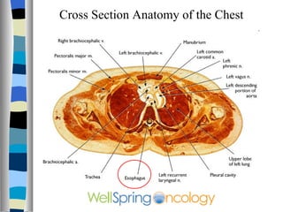 Cross Section Anatomy of the Chest 