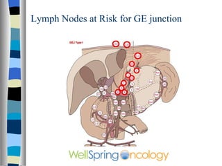 Lymph Nodes at Risk for GE junction 