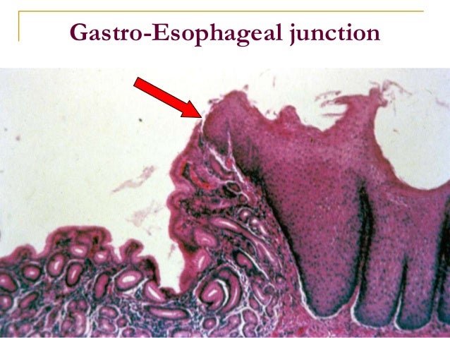 histology esophagus intestine stom