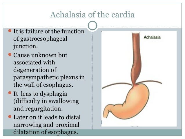 Esophagus stomach-dr.gosai