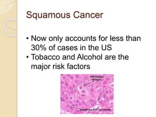 Squamous Cancer 
• Now only accounts for less than 
30% of cases in the US 
• Tobacco and Alcohol are the 
major risk factors 
 
