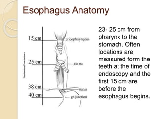 Esophagus Anatomy 
23- 25 cm from 
pharynx to the 
stomach. Often 
locations are 
measured form the 
teeth at the time of 
endoscopy and the 
first 15 cm are 
before the 
esophagus begins. 
 