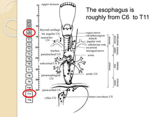 The esophagus is 
roughly from C6 to T11 
 