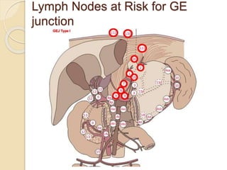 Lymph Nodes at Risk for GE 
junction 
 