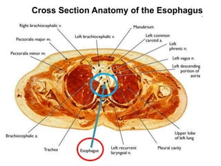 Cross Section Anatomy of the Esophagus 
 