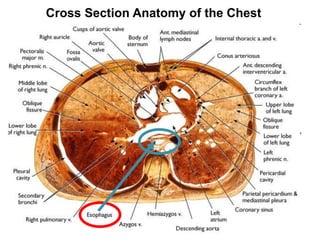 Cross Section Anatomy of the Chest 
 