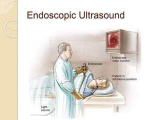Endoscopic Ultrasound 
 