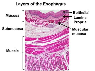 Layers of the Esophagus 
Mucosa 
Submucosa 
Muscle 
Epithelial 
Lamina 
Propria 
Muscular 
mucosa 
 