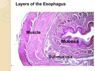 Layers of the Esophagus 
Muscle 
Mucosa 
Submucosa 
 