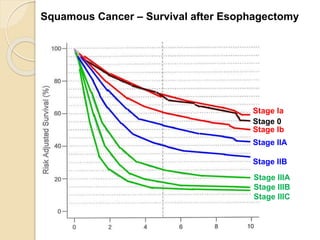 Squamous Cancer – Survival after Esophagectomy 
Stage Ia 
Stage 0 
Stage Ib 
Stage IIA 
Stage IIB 
Stage IIIA 
Stage IIIB 
Stage IIIC 
 